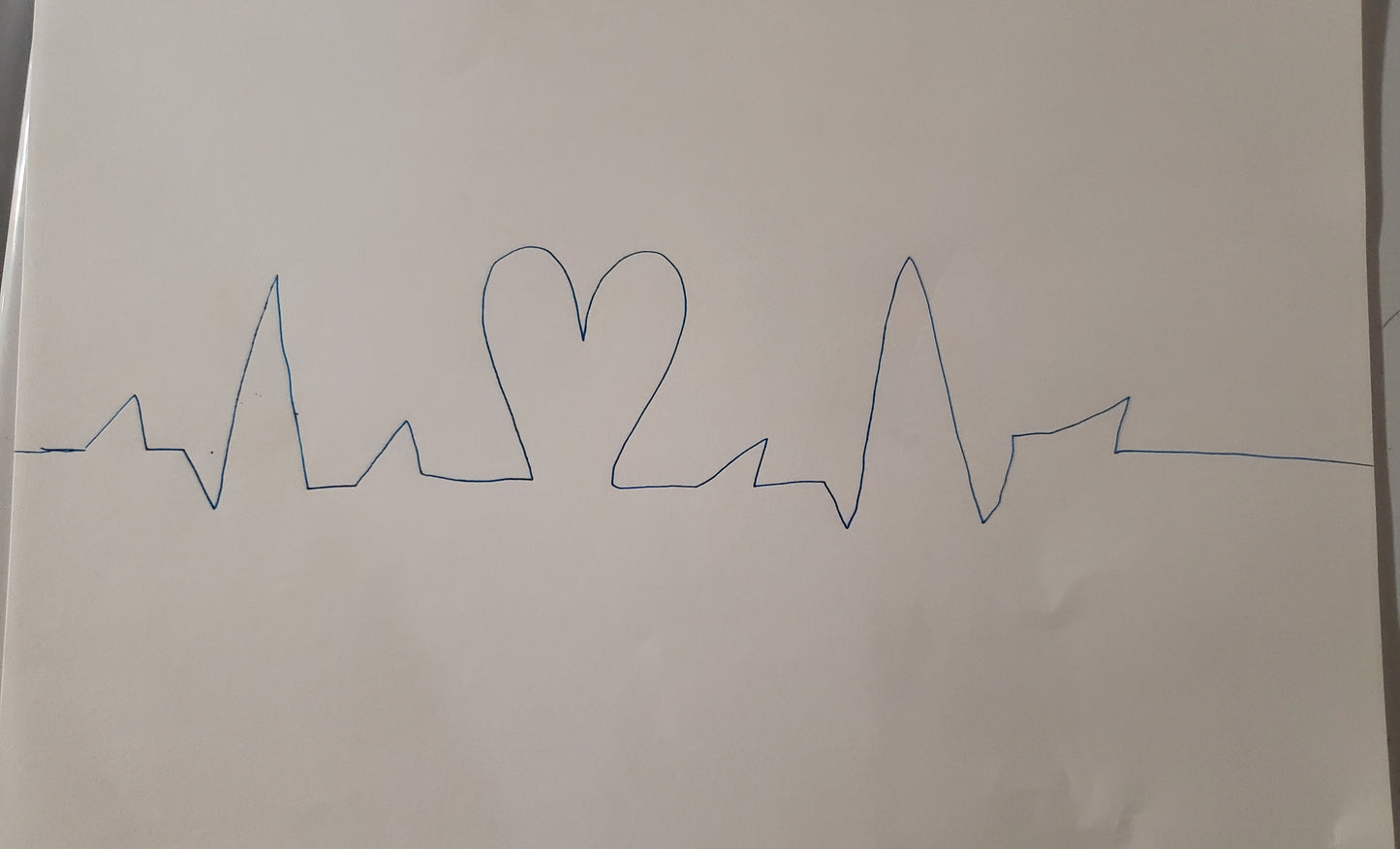 The rhythm of a heart beat